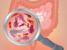 SIBO (Small Intestinal Bacteria Overgrowt) e Tumore Gastrointestinale: i Bifidobatteri combattono la SIBO e ne riducono la sintomatologia