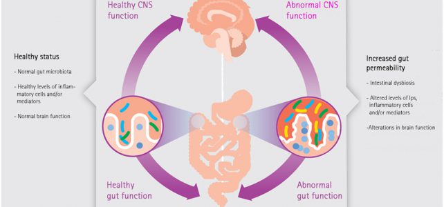 Microbioma Intestinale e Neuroinfiammazione come possibili cofattori di insorgenza della Malattia di Alzheimer